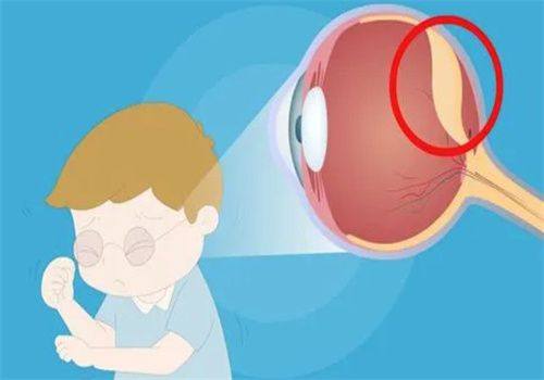 郑州尖峰眼科医院刘保松院长收费贵吗？不贵！他收费合理，技术棒！ 