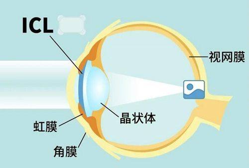 五、如何进行青岛麦迪格眼科医院刁婉丽预约挂号？