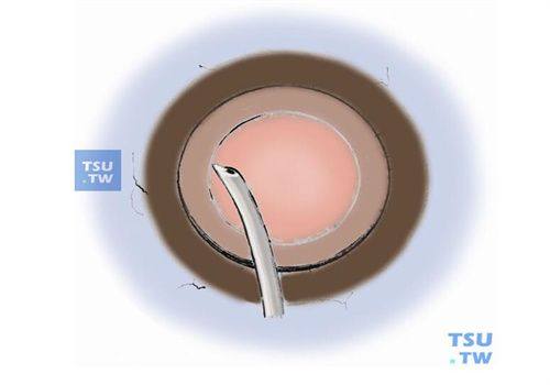 石家庄爱眼眼科医院价格表涵盖多种眼科项目，价格合理透明，想了解近视手术费用的看过来！ 