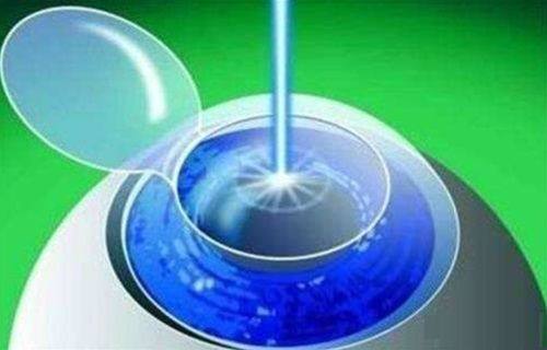 广州市眼科医院收费价格一览表公布：收费合理，值得信赖！ 