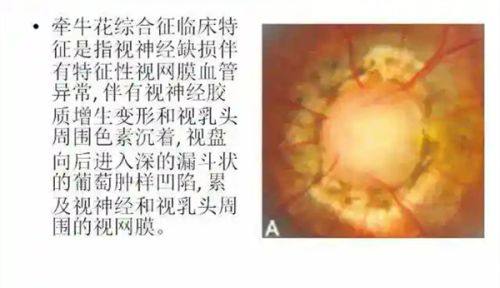 广州市眼科医院收费靠谱吗？当然靠谱，收费透明合理！ 