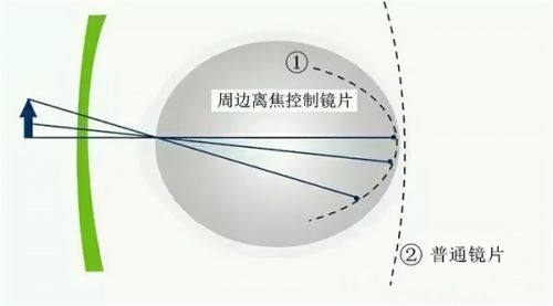 一、石家庄爱眼眼科医院和淮南晨光眼科医院哪家更靠谱？