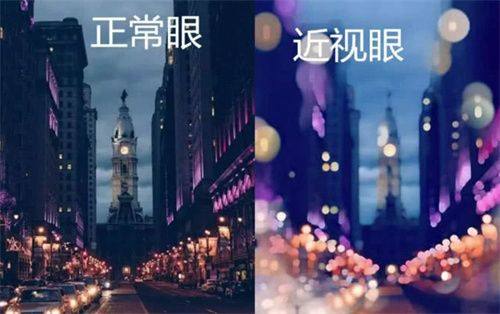 二、石家庄复明眼科医院收费标准怎么样？