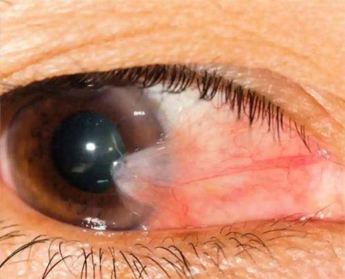 二、郑州市眼科医院收费高不高怎么样？