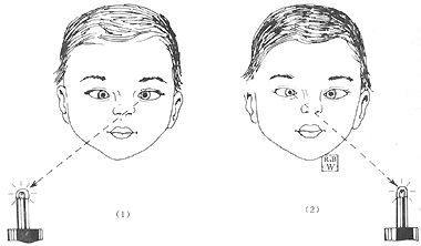 北京民众眼科医院刘津淳做小儿斜视技术好不好？技术靠谱经验丰富，家长放心之选！ 