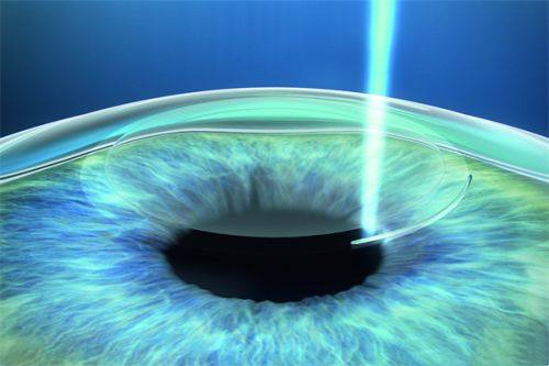 二、郑州爱尔眼科医院价格表背后的优势