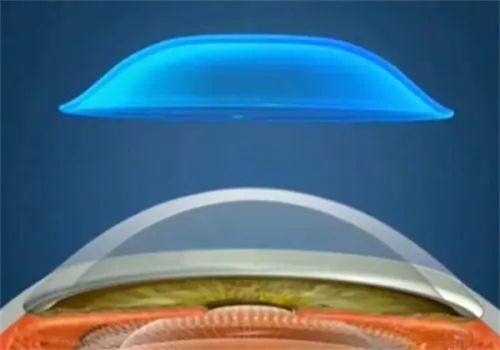 二、广州视百年眼科门诊部收费标准怎么样？