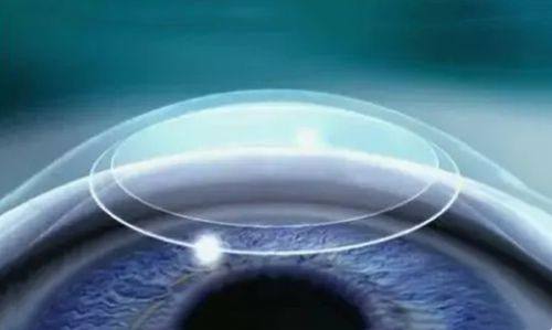 北京熙仁眼科医院价格表：近视手术1.2w元起，收费合理透明！