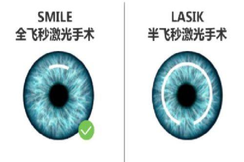 二、徐州华厦眼科价格表背后的优势