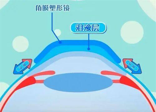 广州爱尔眼科医院高汝龙坐诊时间：工作日的上午，经验丰富医术精湛