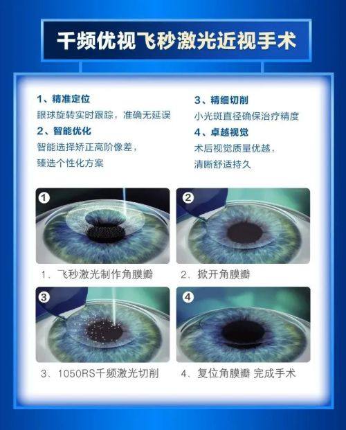 三、兰州爱尔眼科医院医生在儿童眼科的专精服务