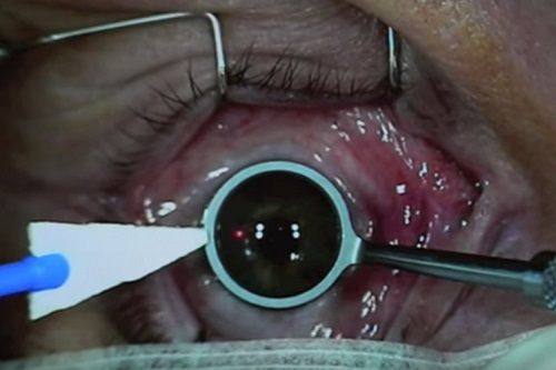 北京熙仁眼科医院封康真实评价如何？口碑超棒，医术精湛、耐心负责获患者一致称赞！ 