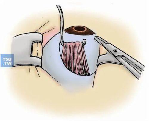 二、江门市眼科医院收费靠谱吗怎么样？