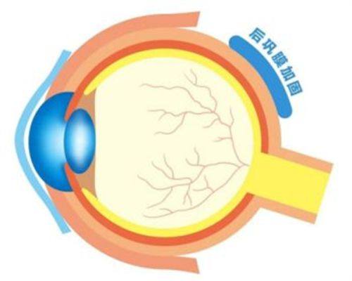  二、广州希玛林顺潮眼科医院林小铭和陆守权哪个更靠谱？