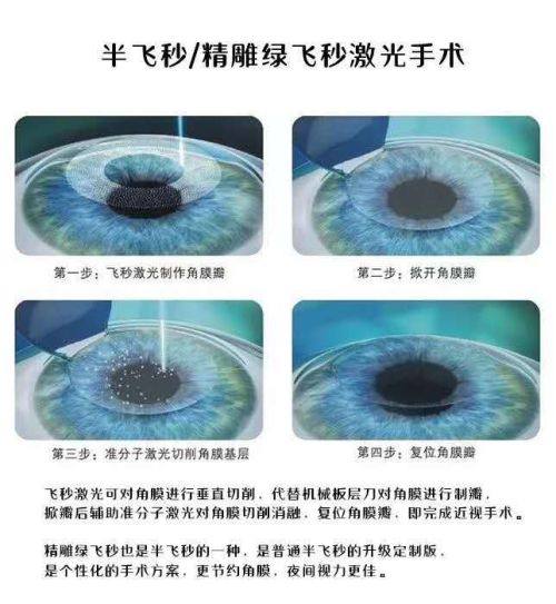 二、广州希玛林顺潮眼科医院林小铭是什么档次？（不同方面回答这个问题字数在10 - 20字）