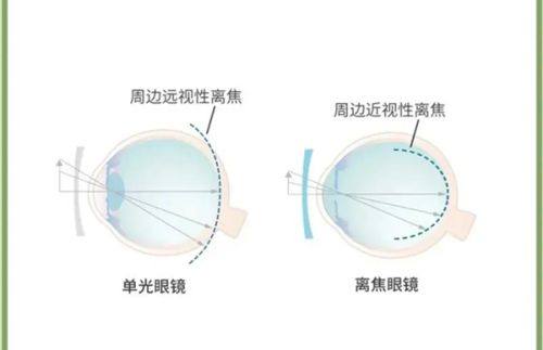三、北京至亮眼科诊所预约挂号之贴心服务体验