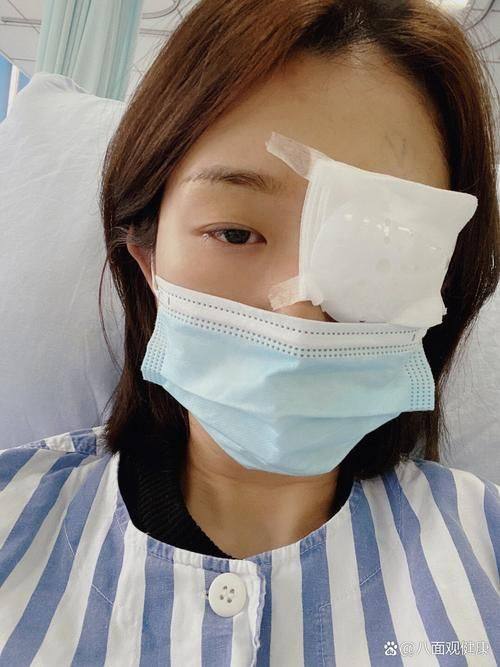 二、北京何氏眼科医院ICL晶体植入术后体验与修复指南