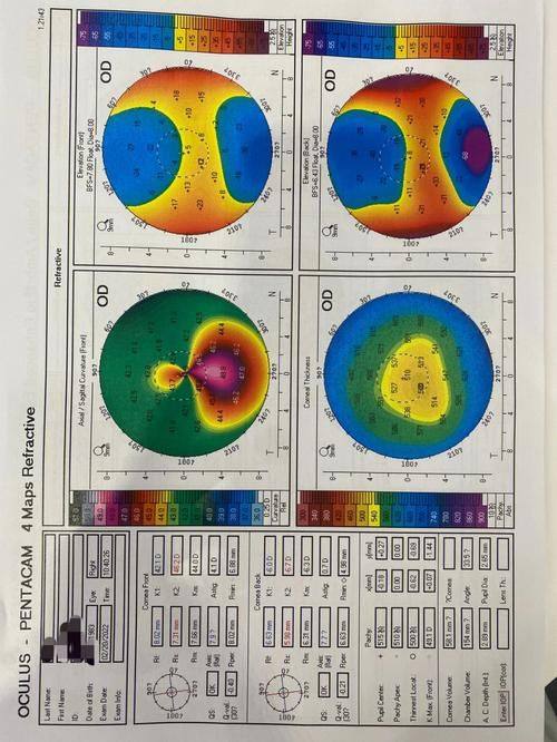二、术后修复与常见疑问：北京何氏眼科常宏医生团队的治疗优势