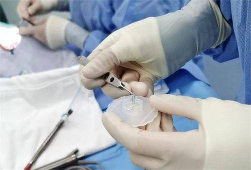 二、中山爱尔眼科医院价格表怎么样？