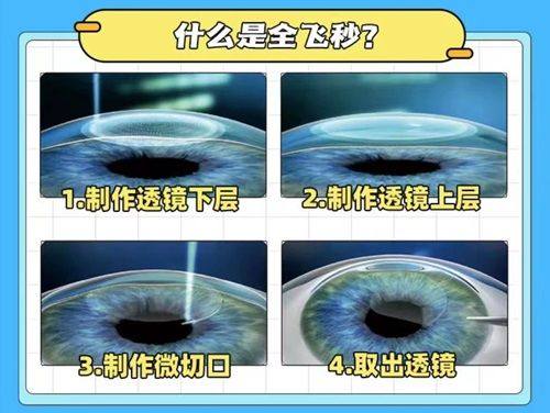 三、贵阳康视眼科医院可靠吗——价格透明合理