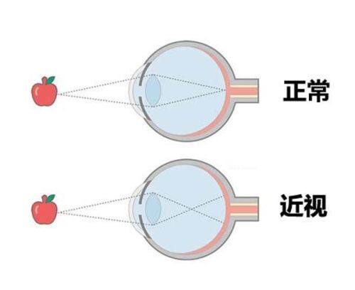 二、深圳新安希玛林顺潮眼科医院收费贵吗怎么样？