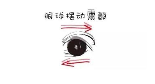 中山爱尔眼科医院收费标准：含白内障/角膜塑形镜等项目！ 