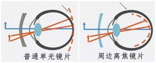 二、贵阳美目眼科医院收费贵吗，它的成效及优势如何？