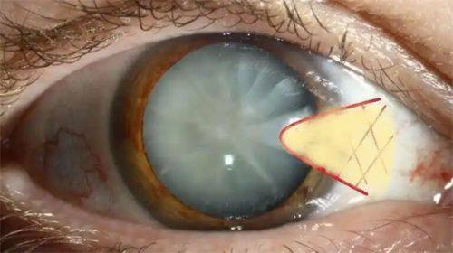 二、医院价格贵不贵？