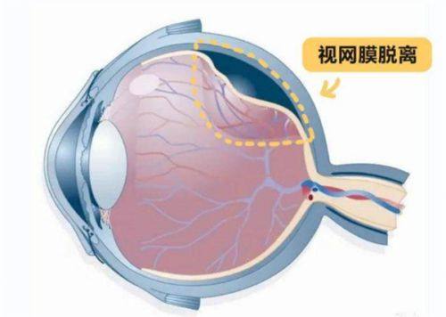 二、贵阳美目眼科医院收费标准背后的优势
