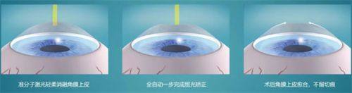 二、贵阳康视眼科医院收费贵吗？优势大揭秘