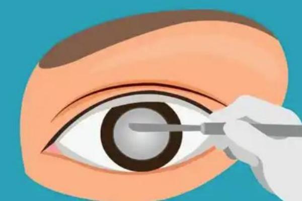 河源爱尔眼科医院价格表