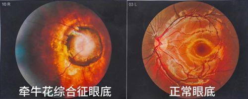 二、深圳新安希玛林顺潮眼科医院收费标准怎么样？