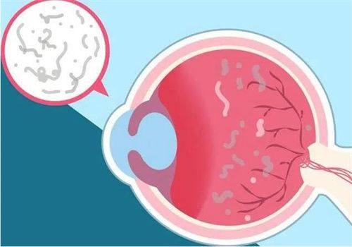二、南京维视眼科医院收费标准背后的优势