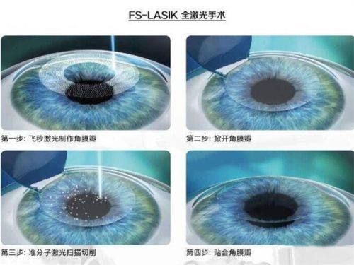 二、武汉佰视佳眼科医院在儿童斜弱视治疗上的独特之处