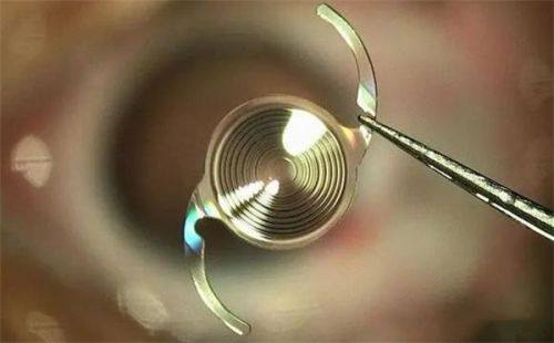 二、武汉佰视佳眼科医院正规吗——术后贴心护理服务