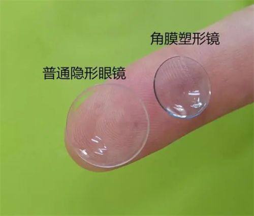 二、南京同仁医院眼科收费贵吗？优势在哪里？