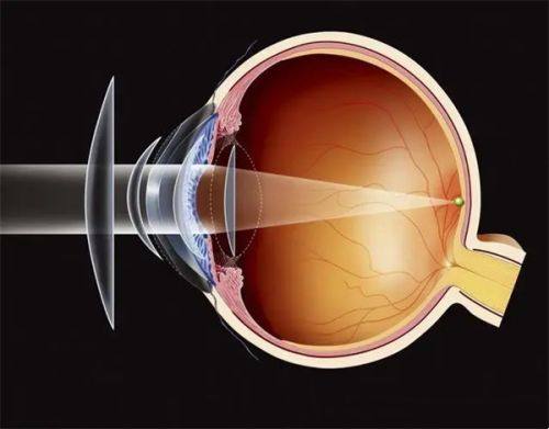 三、徐州爱尔眼科医院口碑评价之合理收费标准