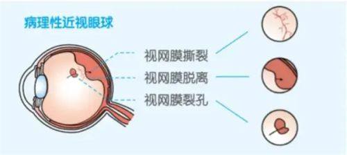 二、常州华厦谱瑞眼科价格表背后的成效及优势