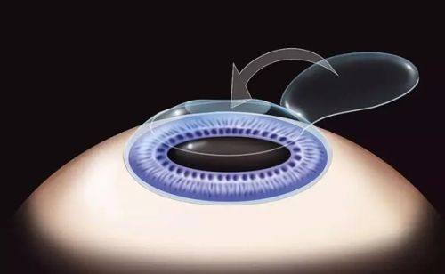 二、无锡华厦眼科医院收费标准背后的优势