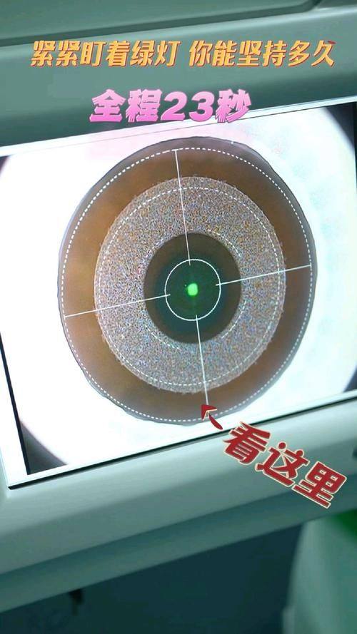 全飞秒激光费用