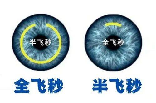 二、郑州中视眼科医院收费贵吗怎么样？