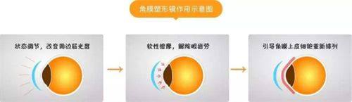 武汉协和医院眼科价格表曝光：白内障手5500元起，icl30800元起！ 