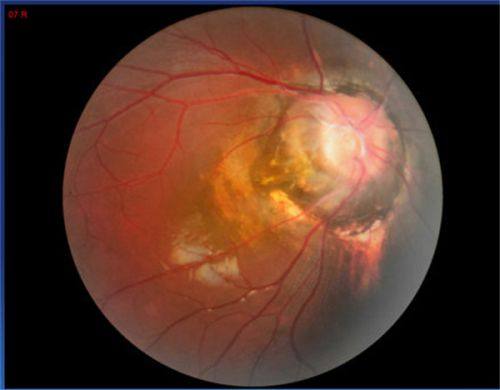 二、郑州美视美康眼科医院医生简介：田琦、王卫群、罗昳医生技术好