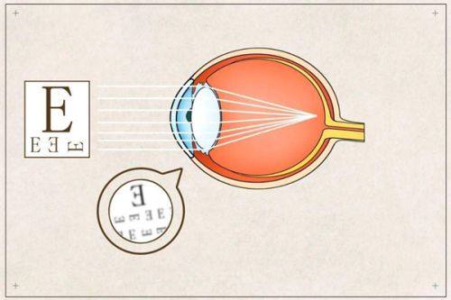 二、珠海希玛林顺潮眼科医院收费贵吗？优势大揭秘