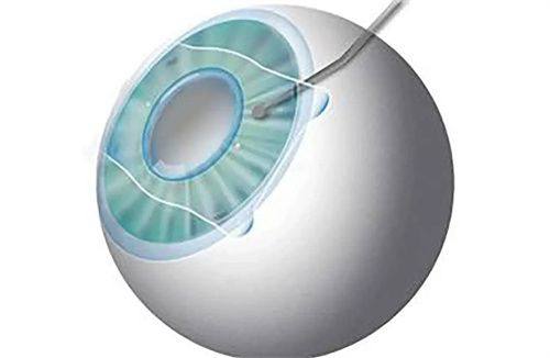 二、医院的特色项目有哪些？