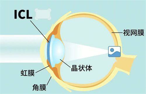 二、北京何氏眼科医院是国有的吗——亲民价格与医疗保险覆盖