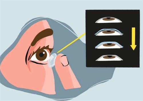 二、北京麦迪格眼科医院收费不贵但成效和优势如何？