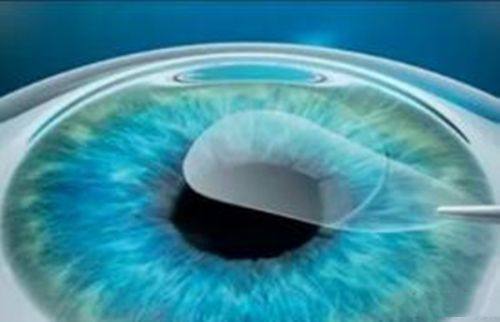 二、北京维视眼科医院营业时间内的快速就诊流程