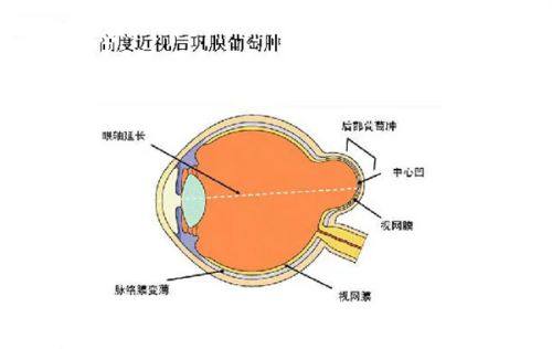 三、北京维视眼科医院在价格透明上正规吗