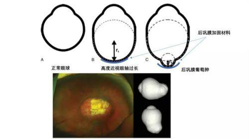 二、北京爱尔英智眼科医院价格表背后的成效及优势